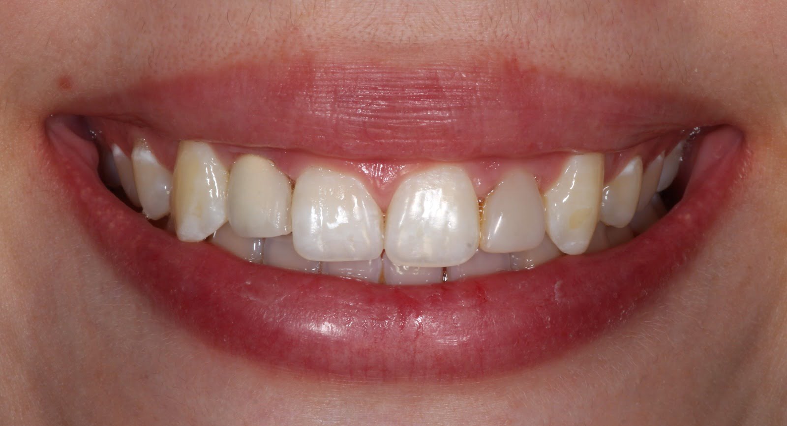 sonrisa