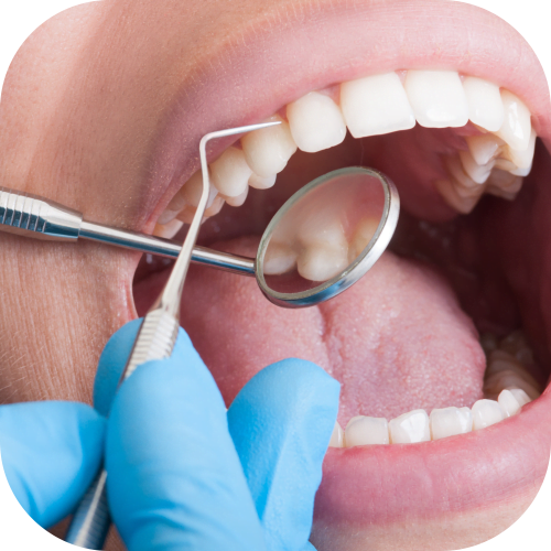 Periodoncia